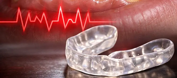 Desgaste dental por bruxismo